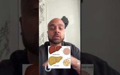 Fatty liver is exploding! And here’s why Comment “part 2” for the next video explaining the end#fatt